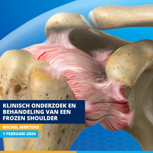 Klinisch onderzoek en behandeling van een frozen shoulder